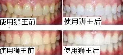 5.30团品Lion狮王酵素美白牙膏